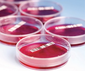 Petri_dishes_with_blood_samples
