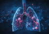 Sino Biopharm AstraZeneca Licence Agreement